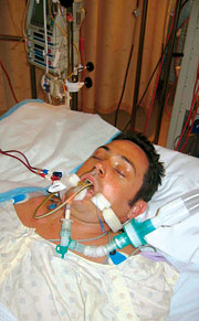 Stuart in his medical induced coma - Stuart-lines-4